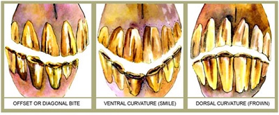 Equine teeth misalignment